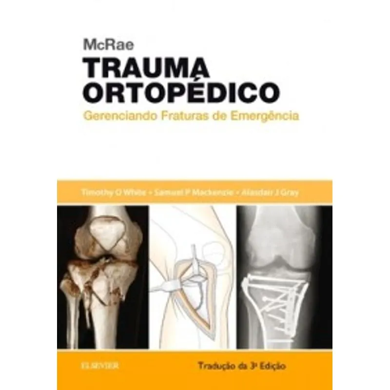 Livro - McRae Trauma Ortopédico - Gerenciando Fraturas de Emergência - White