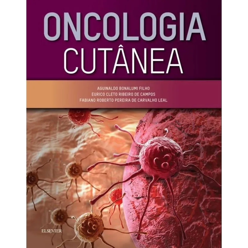 Oncologia Cutanea