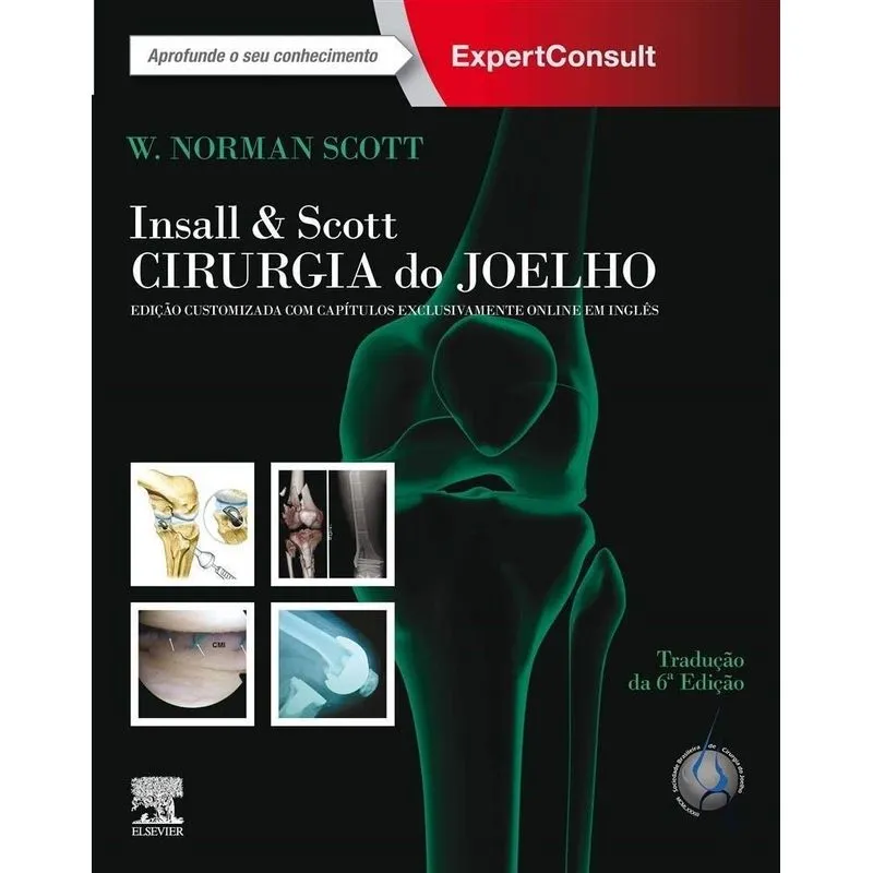 Insall & Scott Cirurgia do joelho