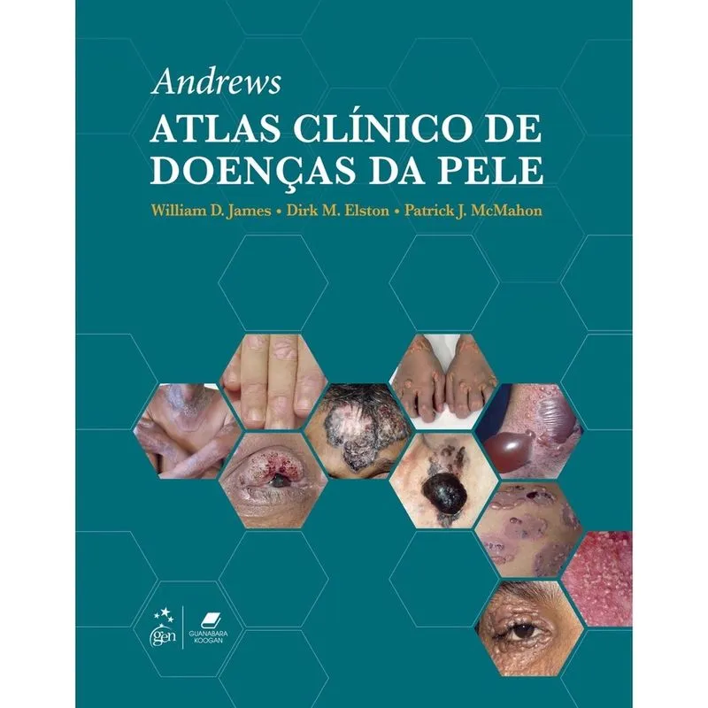 Andrew Atlas Clínico De Doenças Da Pele - 1ª Ed. Livro - Andrews Atlas Clínico de Doenças da Pele