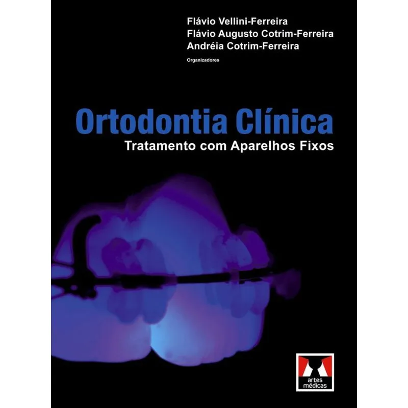 Livro - Ortodontia Clínica - Tratamento com Aparelhos Fixos - Vellini