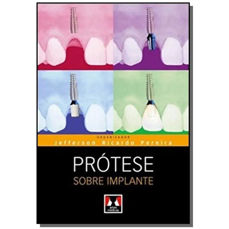 PROTESE SOBRE IMPLANTE