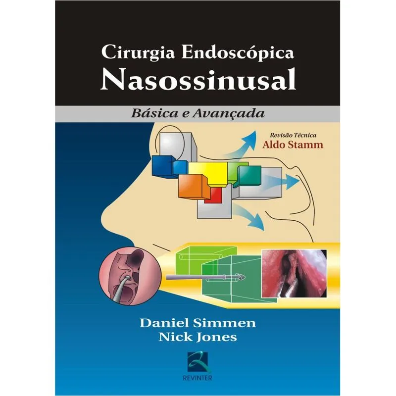 Cirurgia endoscópica nasossinusal
