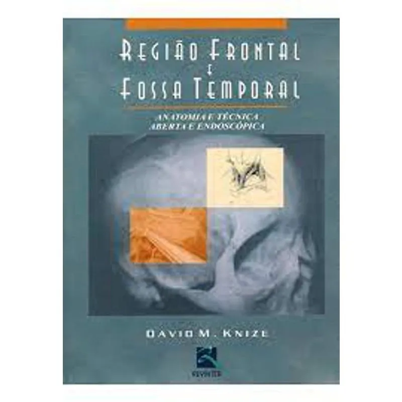 Livro - Região Frontal E Fossa Temporal - Anatomia E Técnica