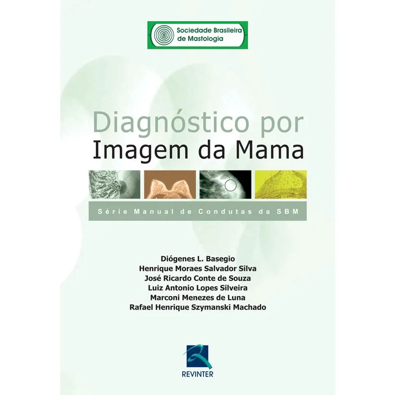 Livro - SBM Diagnóstico por Imagem da Mama: Série Manual de Condutas da SBM