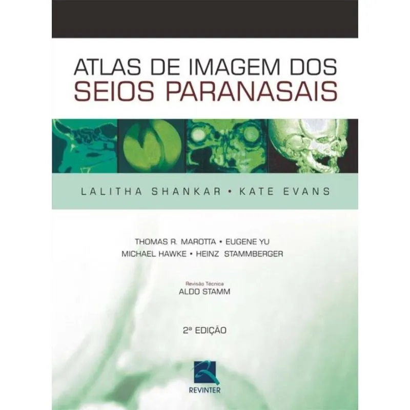 Atlas De Imagem Dos Seios Paranasais