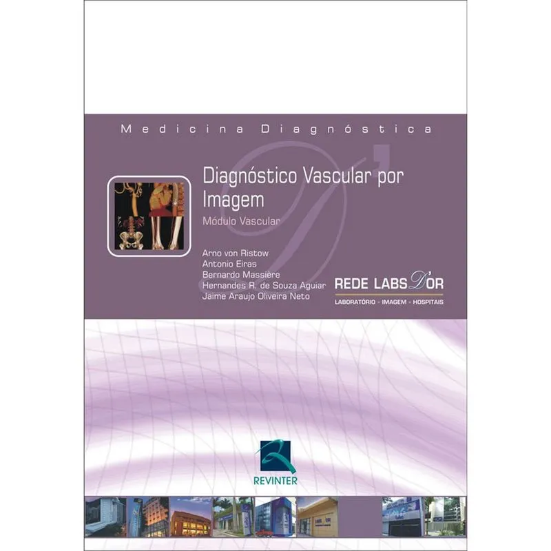 Diagnóstico vascular por imagem
