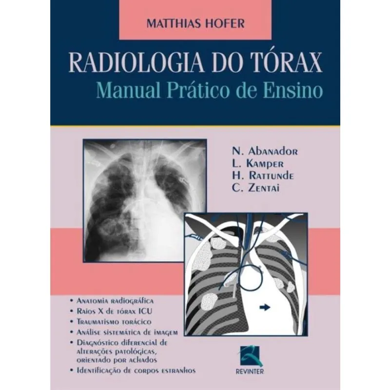 Radiologia Do Tórax