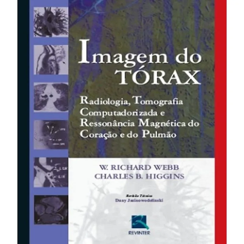 Imagem Do Torax