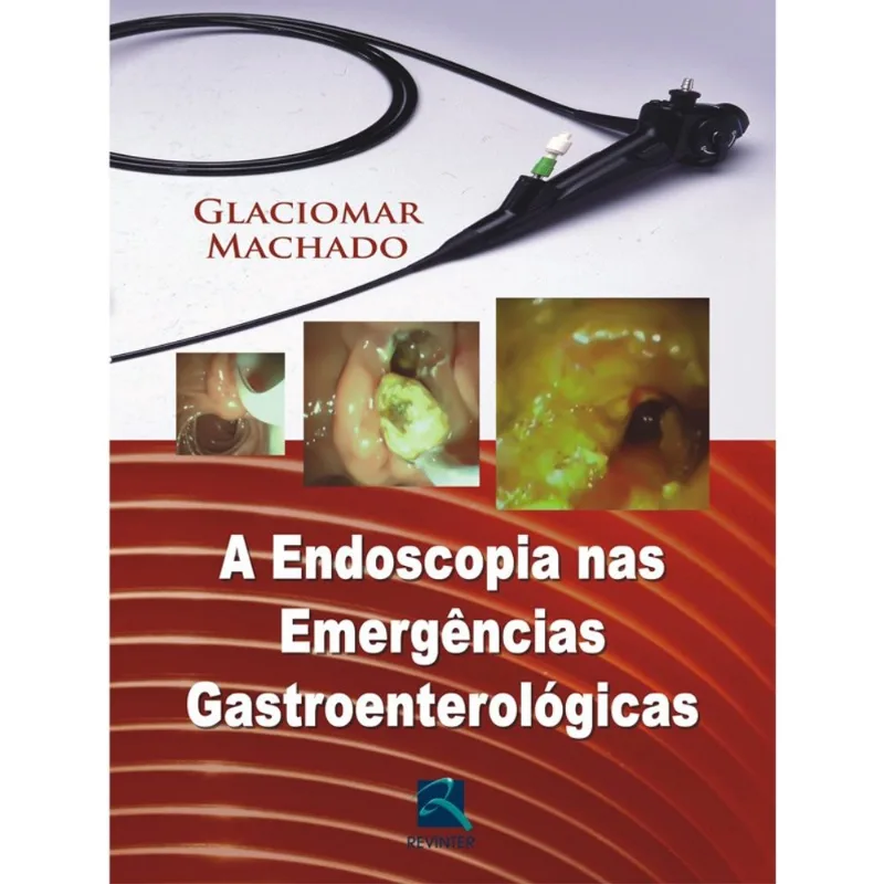 A Endoscopia nas Emergências Gastroenterológicas