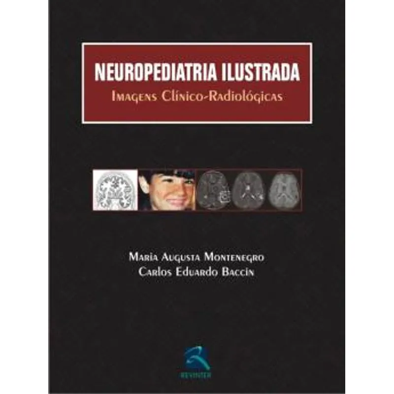 NEUROPEDIATRIA ILUSTRADA