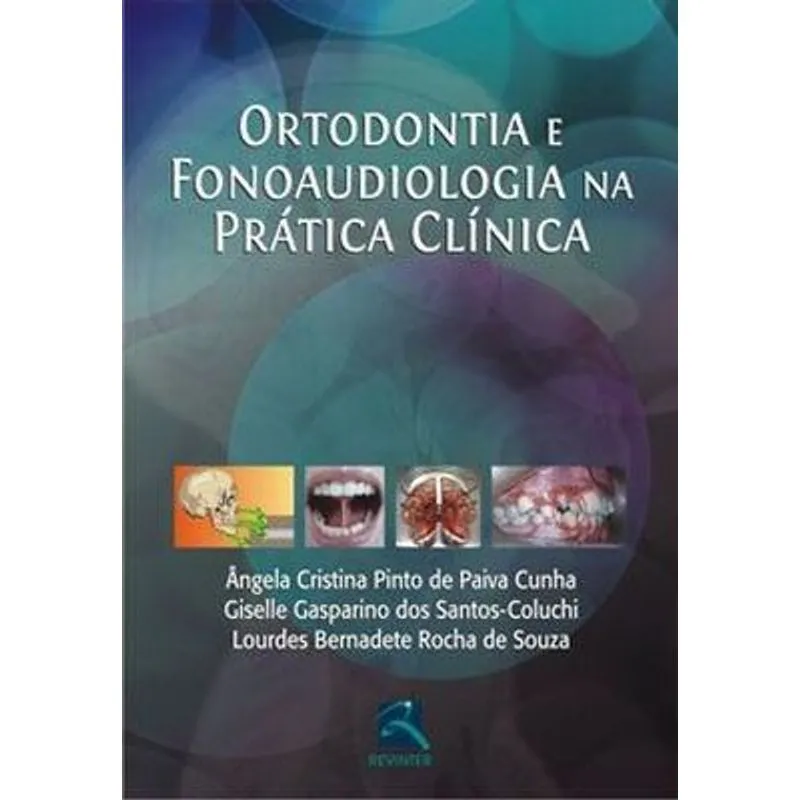Livro - Ortodontia e Fonoaudiologia na Prática Clínica - Cunha