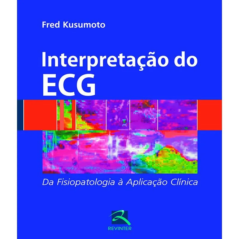 Interpretacao Do Ecg