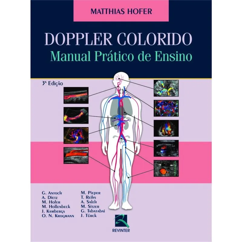 Doppler Colorido