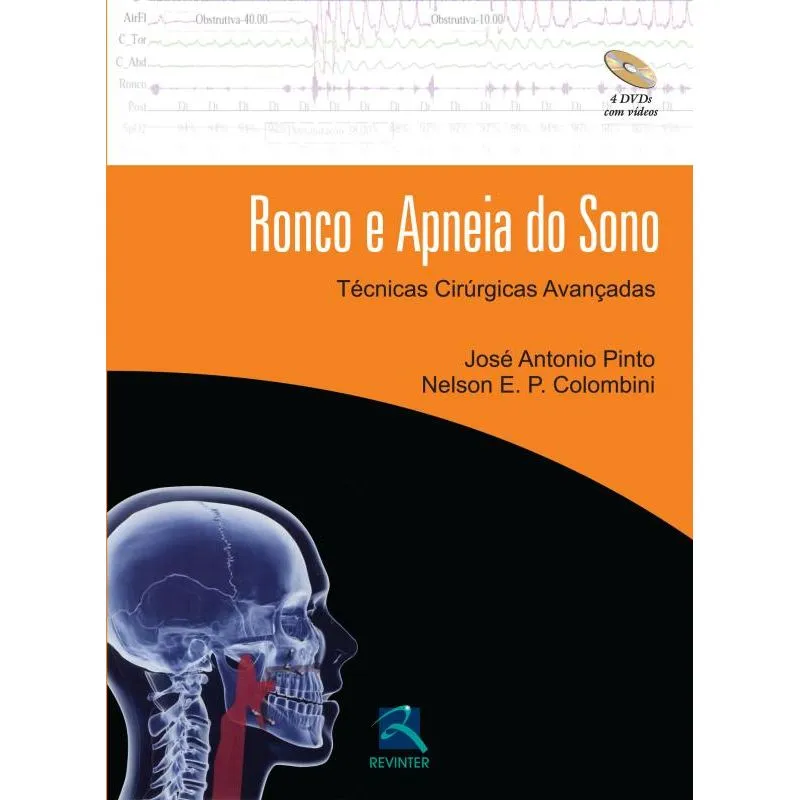 Ronco E Apneia Do Sono