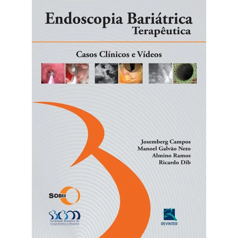 ENDOSCOPIA BARIATRICA TERAPEUTICA