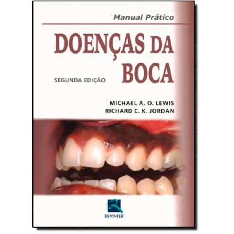 DOENCAS DA BOCA - 2ª ED