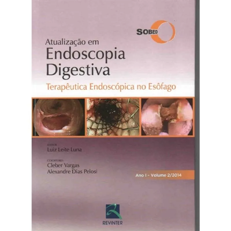 Atualizacao Em Endoscopia Digestiva Terapeutica Endoscopica No Esofago