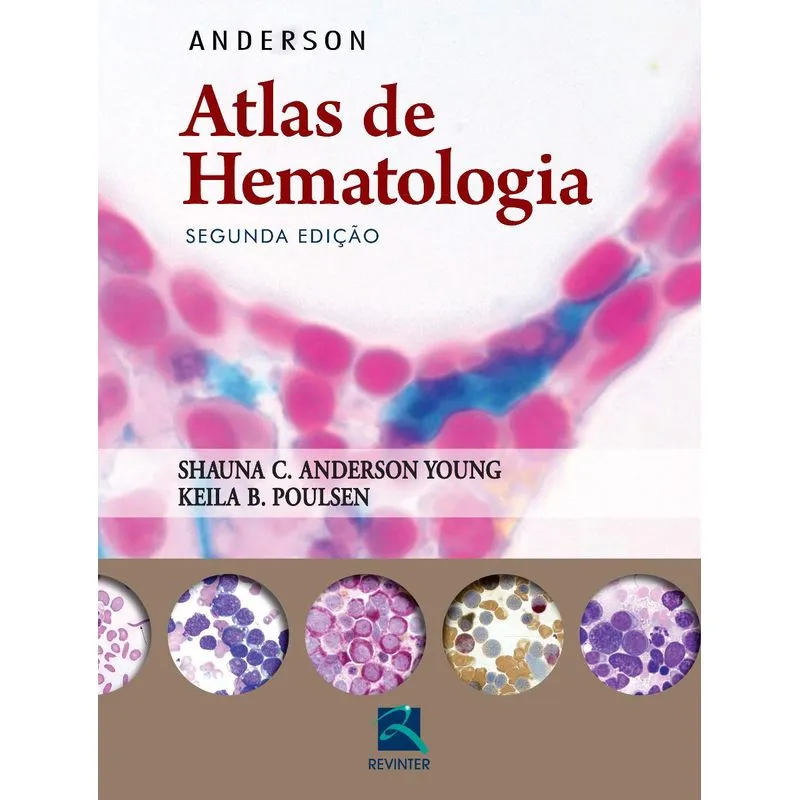 Anderson - Atlas de hematologia