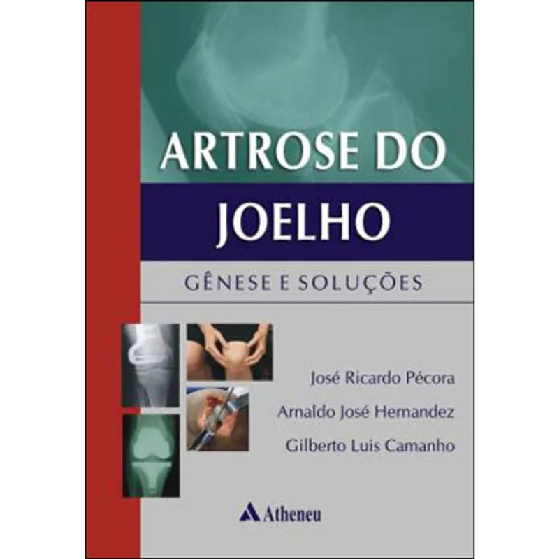ARTROSE DO JOELHO
