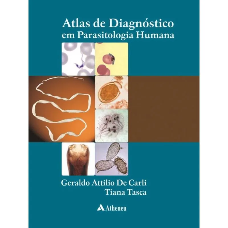 Atlas de Diagnóstico em Parasitologia Humana (pod)