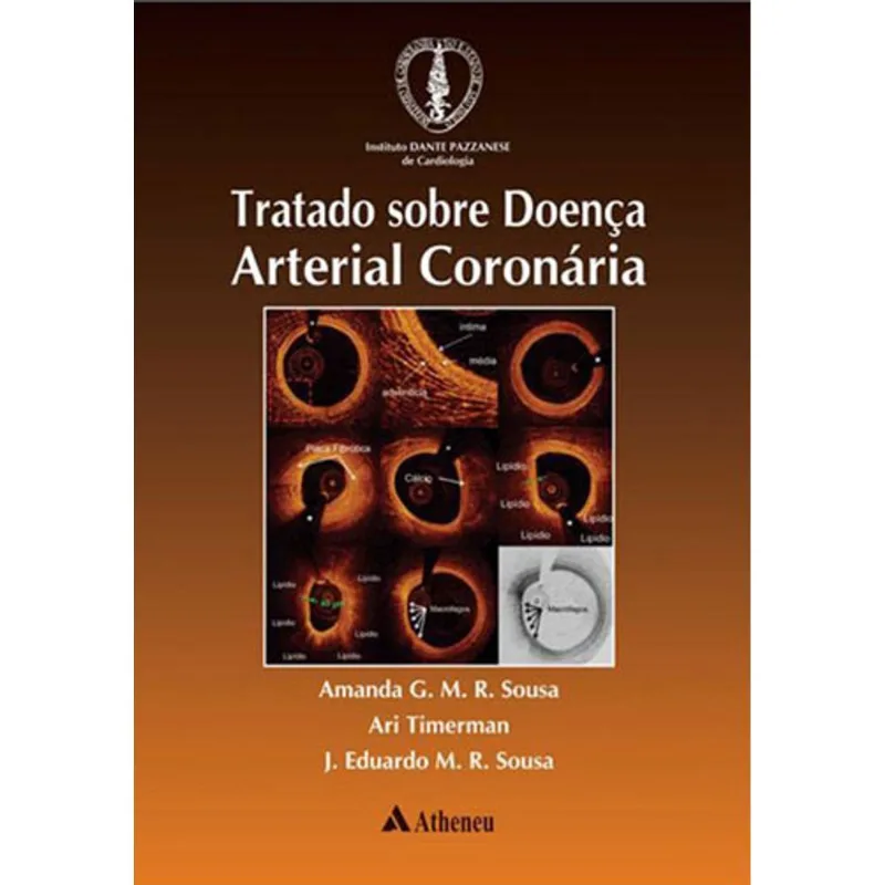 TRATADO SOBRE DOENÇA ARTERIAL CORONÁRIA