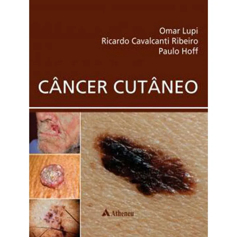 CÂNCER CUTÂNEO