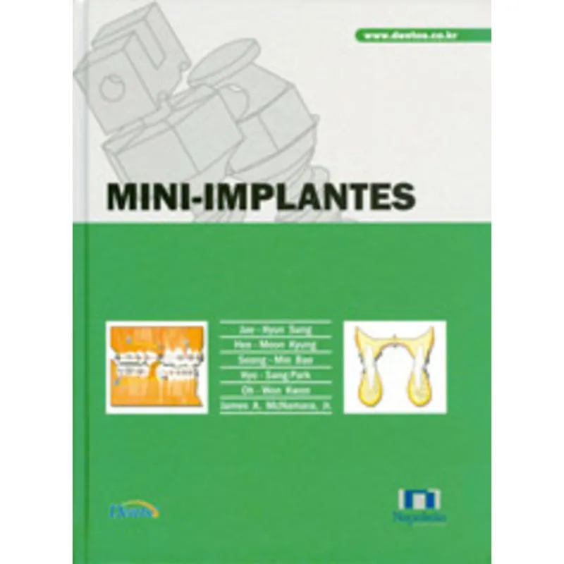Livro - Mini Implantes - James