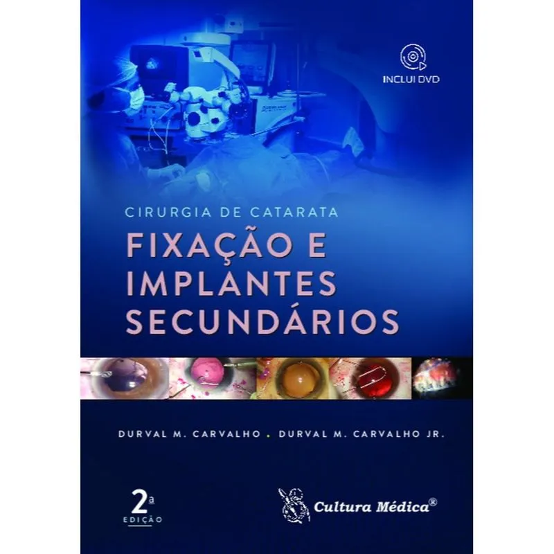 Cirurgia de catarata