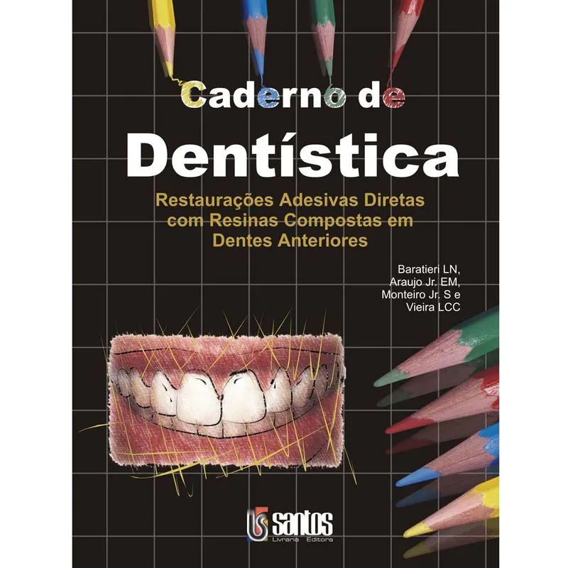 Livro - Caderno de Dentística - Restaurações Adesivas Diretas em Res. - Baratieri