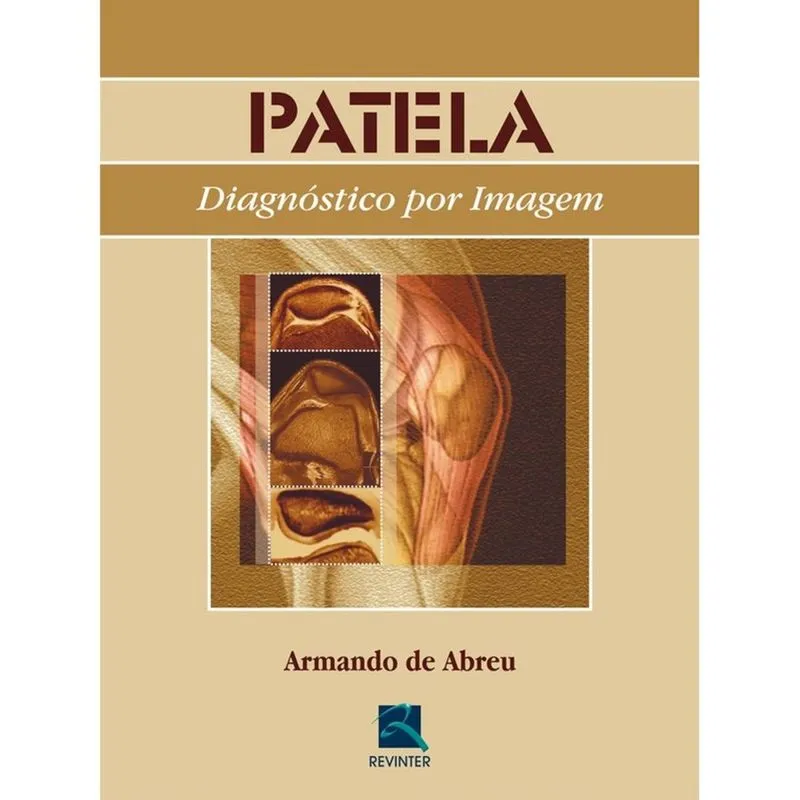 Patela