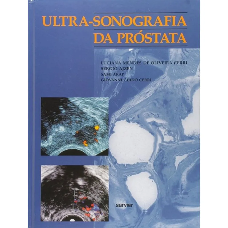 Ultra Sonografia Da Próstata
