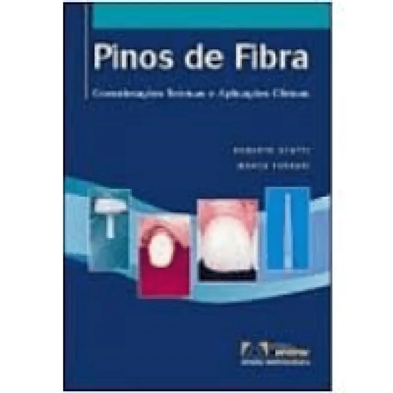 Pinos De Fibra Considerações Teóricas A Aplicações Clinicas