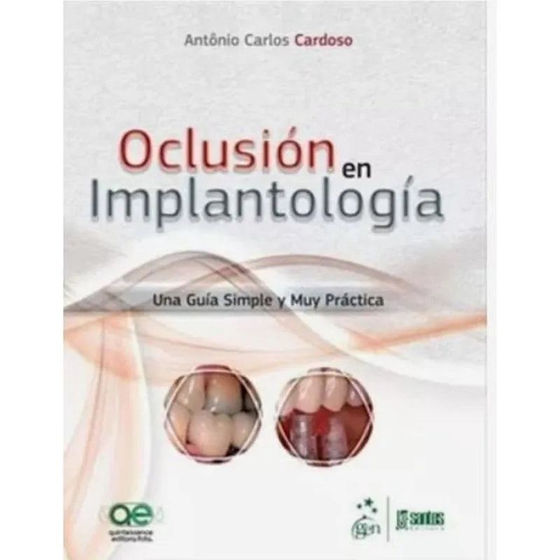Oclusión en implantología