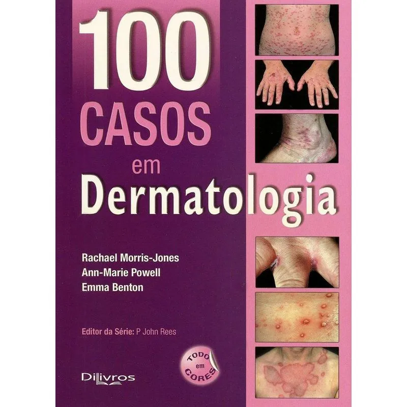 100 Casos em Dermatologia