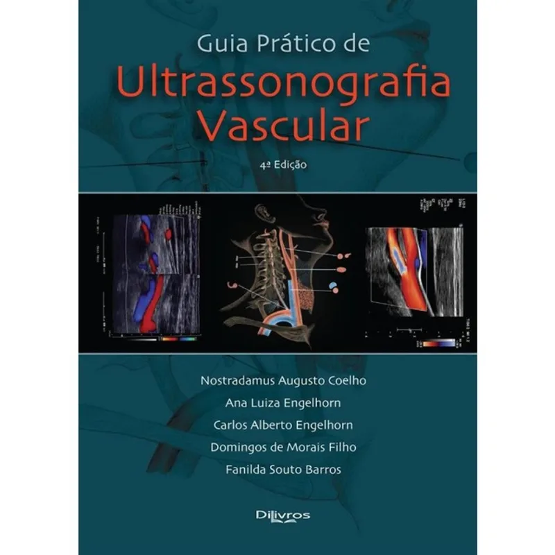 GUIA PRÁTICO DE ULTRASSONOGRAFIA VASCULAR