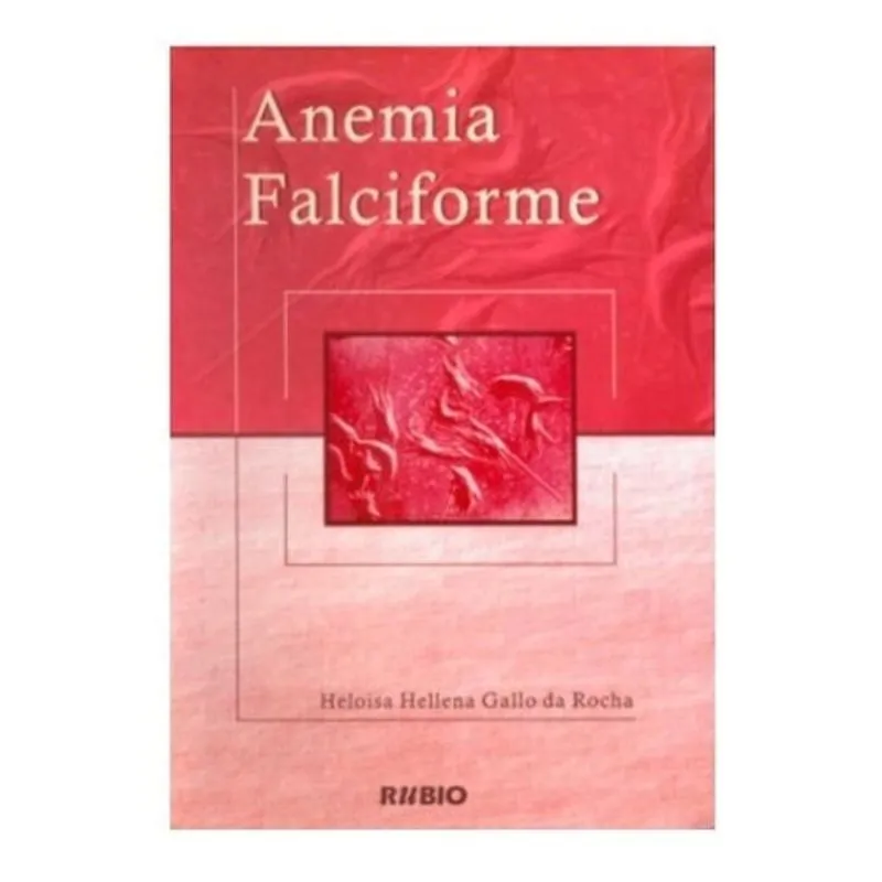 ***anemia Falciforme***