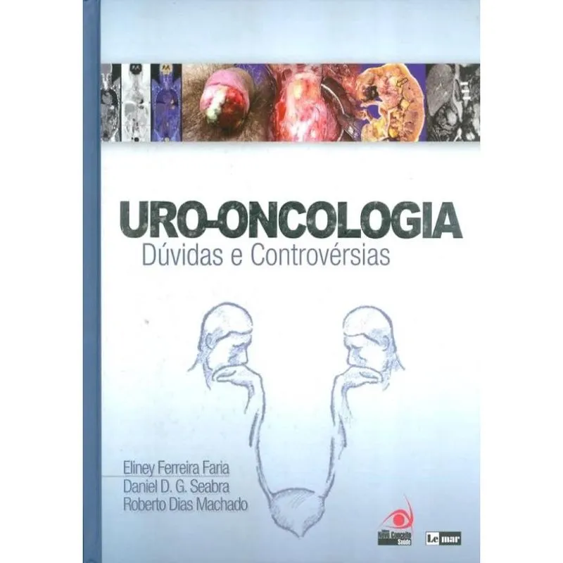 Uro-Oncologia Duvidas E Controversias