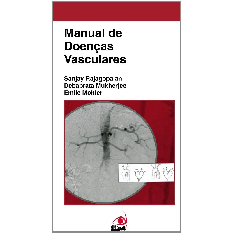 Manual de doencas vasculares
