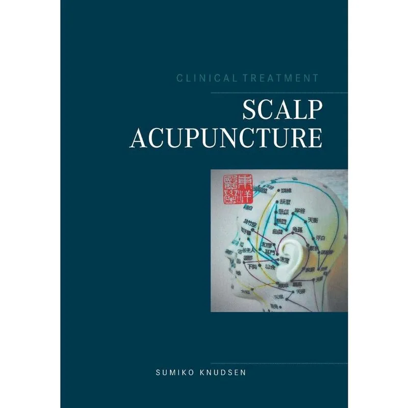 Scalp Acupuncture