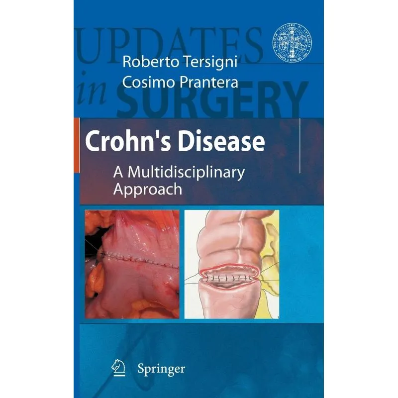 Crohns Disease