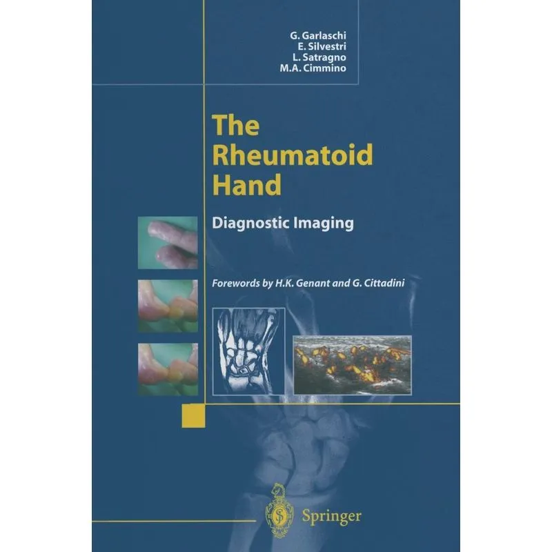 The Rheumatoid Hand