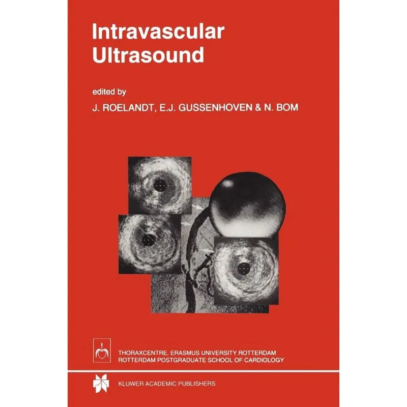 Intravascular Ultrasound