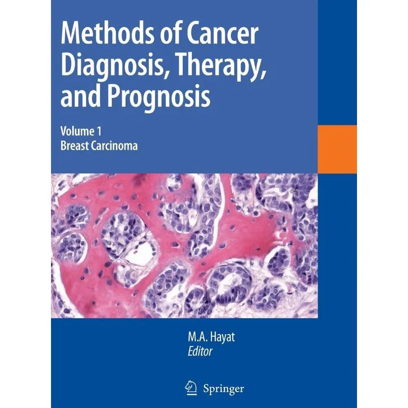 Methods of Cancer Diagnosis, Therapy and Prognosis