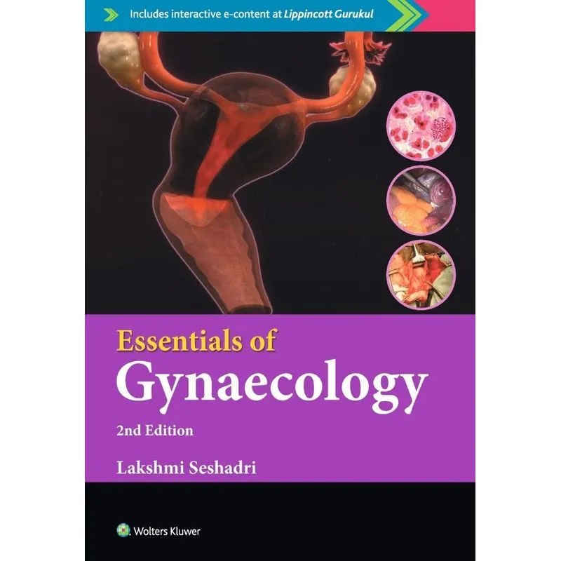 Essentials of Gynaecology, 2/e