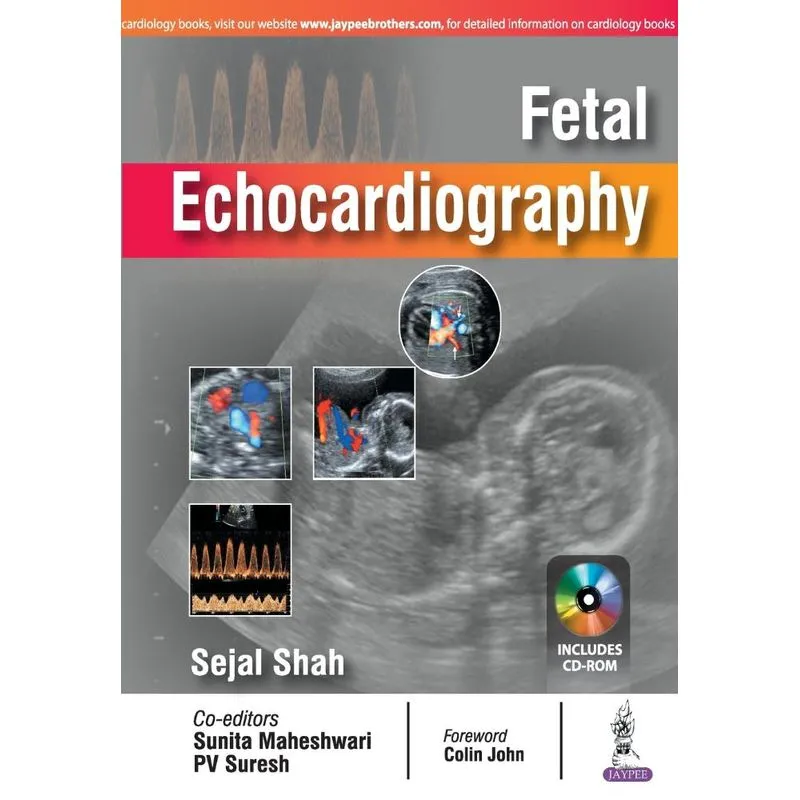 Fetal Echocardiography