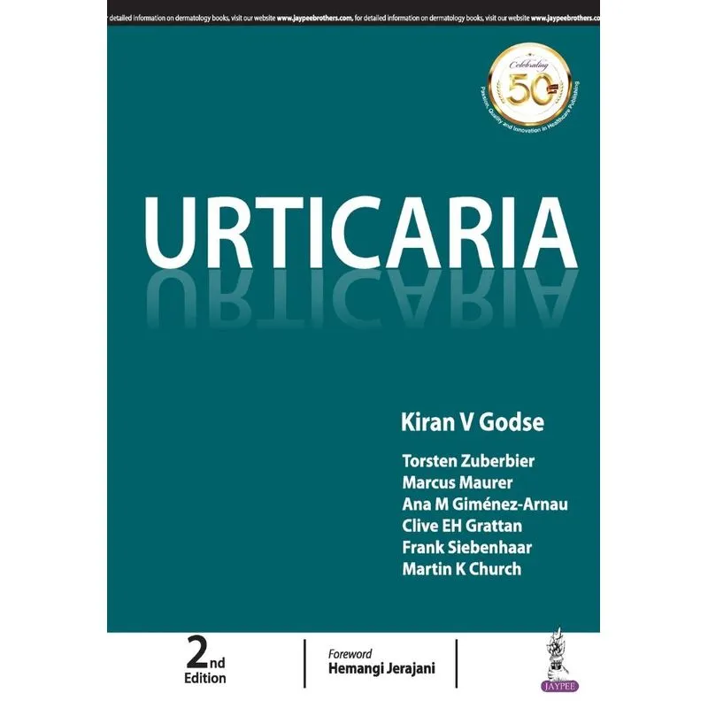 Urticaria