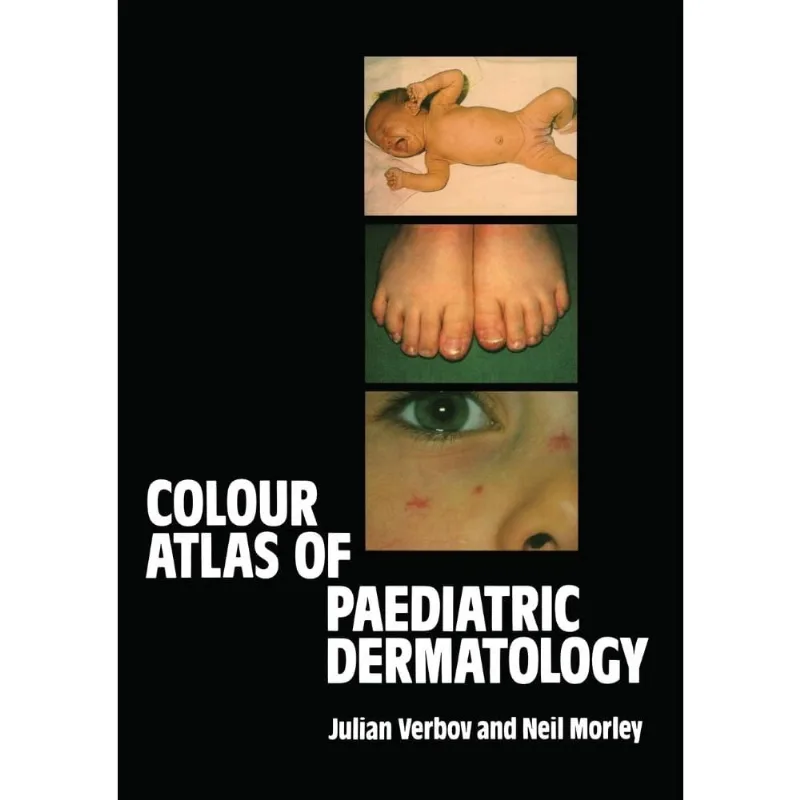 Colour Atlas of Paediatric Dermatology