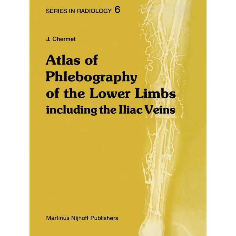 Atlas of Phlebography of the Lower Limbs