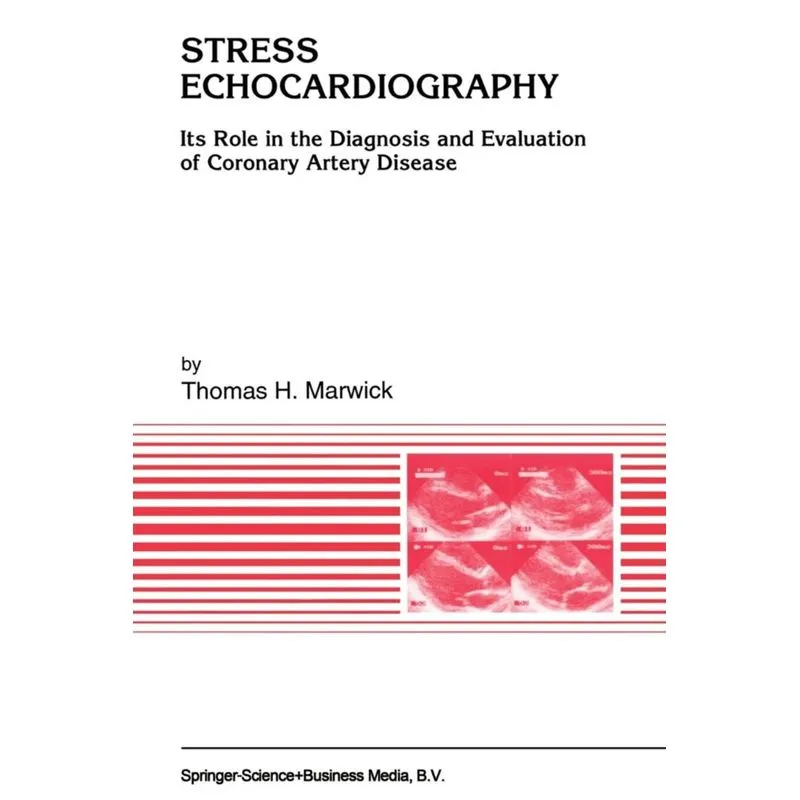 Stress Echocardiography